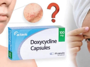 Doxycycline pour l’acné : à partir de quand ça marche ?